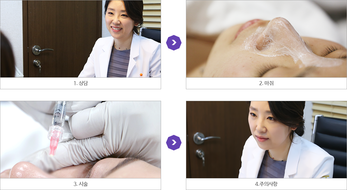 시술과정