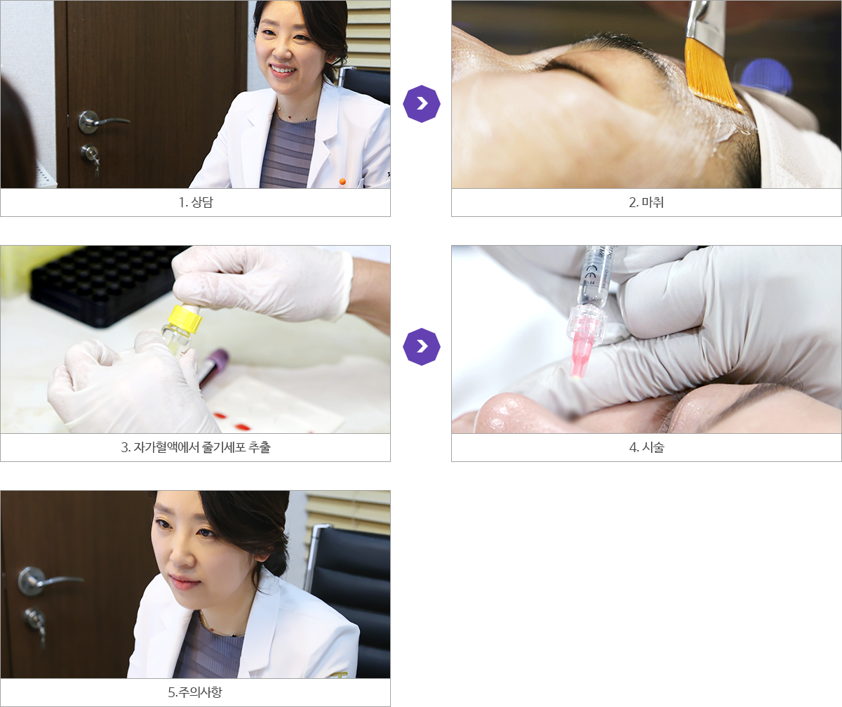 시술과정