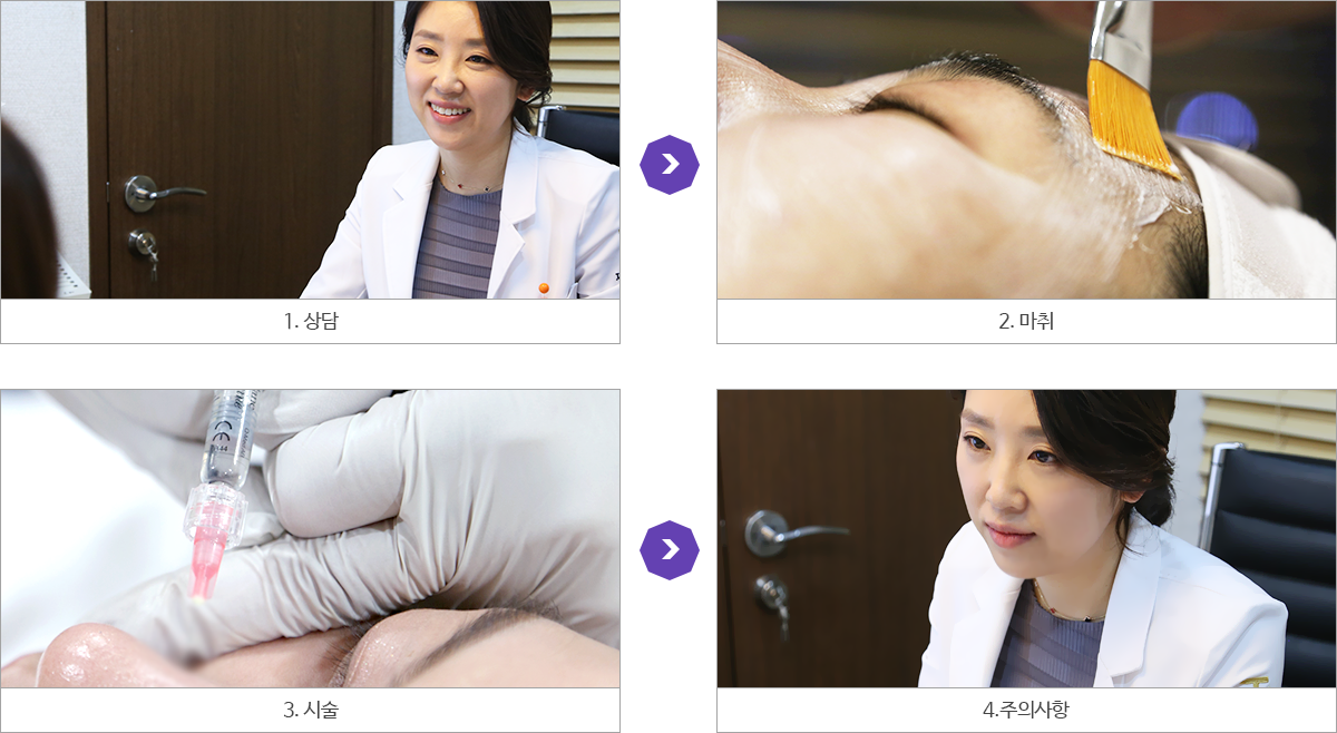 시술과정