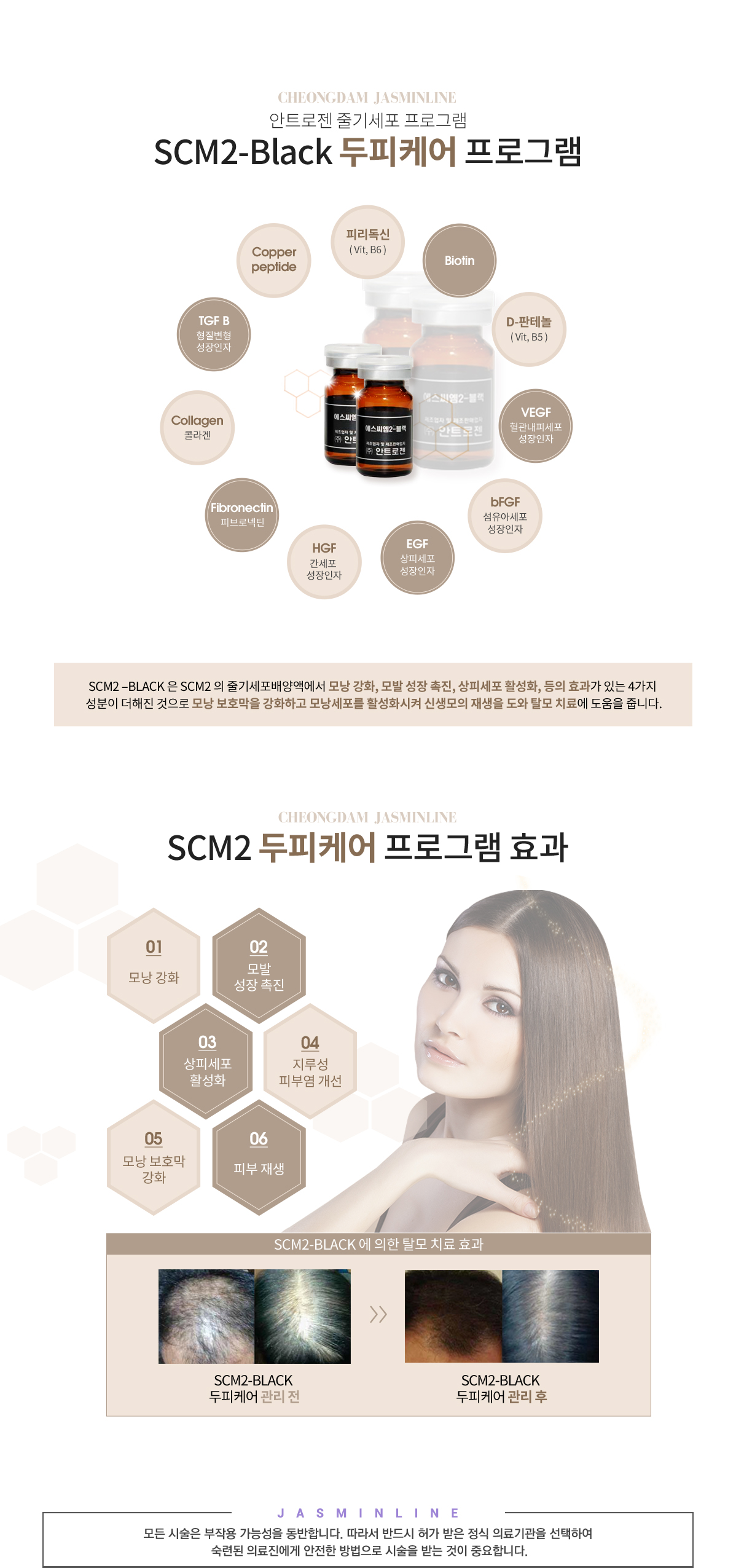 SCM2 줄기세포테라피